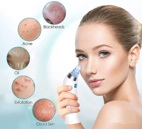 Derma Suction Blackhead Remover Vacuum Suck The Yuck Out Of Your Pores (cell Operated) - the makoza hub