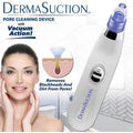 Derma Suction Blackhead Remover Vacuum Suck The Yuck Out Of Your Pores (cell Operated) - the makoza hub